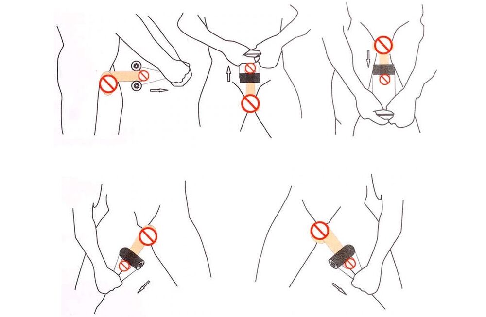 جیلکینگ برای بزرگ کردن آلت تناسلی